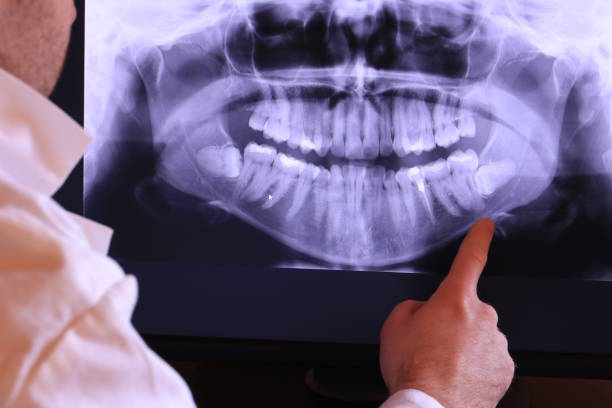 Best Emergency Broken Tooth Repair in Fridley, MN